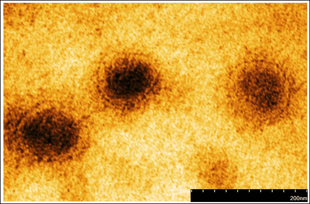 長庚團隊與國防醫學院預防醫學研究所合作電子顯微鏡下的新冠病毒影像-1