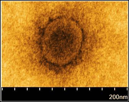 長庚團隊與國防醫學院預防醫學研究所合作電子顯微鏡下的新冠病毒影像-2